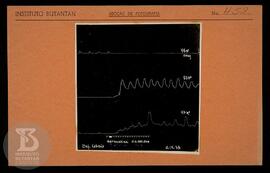 reprodução de gráfico. Ficha da Seção de fotografia nº 459, solicitado pela Seção de Fisiologia (...