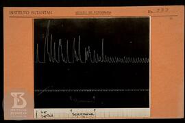 Reprodução de gráfico. Ficha da Seção de fotografia nº 333, solicitado pela Seção de Fisiologia (...