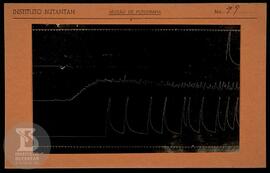 Reprodução de gráfico. Ficha da Seção de fotografia nº 79, solicitado pela Seção de Fisiologia (D...