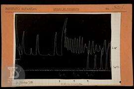 Reprodução de gráfico. Ficha da Seção de fotografia nº 328, solicitado pela Seção de Fisiologia (...