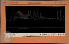 Reprodução de gráfico. Ficha da Seção de fotografia nº 331, solicitado pela Seção de Fisiologia (...