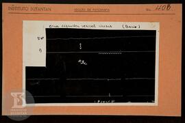 Reprodução de gráfico sobre "zona esfíncter vesical rhesus (bario). Ficha da Seção de fotogr...