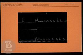 Reprodução de gráfico. Ficha da Seção de fotografia nº 96, solicitado pela Seção de Fisiologia (D...