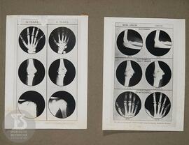 Instituto Butantan Cobras do Brasil Vol. 3. Fotografia da esquerda: “fig. 211 Roentgenographic st...