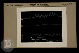 reprodução de gráfico. Ficha da seção de fotografia nº 1107, solicitado pela Seção de Fisiopatolo...