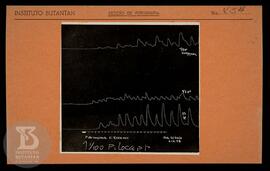 reprodução de gráfico. Ficha da Seção de fotografia nº 454, solicitado pela Seção de Fisiologia (...