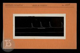reprodução de gráfico. Ficha da Seção de fotografia nº 547, solicitado pela Seção de Fisiopatolog...