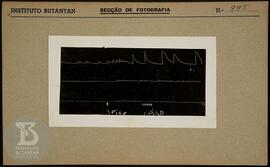 Reprodução de gráfico. Ficha da Seção de fotografia nº 995, solicitado pela Seção Fisiopatologia ...