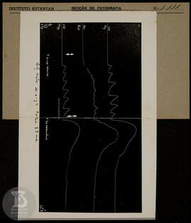 Gráfico sem legenda. Ficha da Seção de fotografia nº 1111, solicitação da Seção de Fisiopatologia...