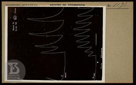 Reprodução de gráfico. Ficha da Seção de fotografia nº 1191, solicitado pela Seção de Fisiopatolo...