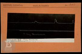 Reprodução de gráfico. Ficha da Seção de fotografia nº 343, solicitado pela Seção de Fisiologia (...