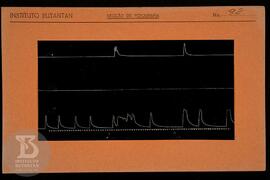 Reprodução de gráfico. Ficha da Seção de fotografia nº 92, solicitado pela Seção de Fisiologia (D...