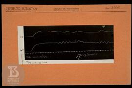 Reprodução de gráfico. Ficha da Seção de fotografia nº 342, solicitado pela Seção de Fisiologia (...