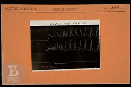 Reprodução de gráfico. Ficha da Seção de fotografia nº 347, solicitado pela Seção de Fisiologia (...