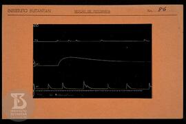 Reprodução de gráfico. Ficha da Seção de fotografia nº 86, solicitado pela Seção de Fisiologia (D...