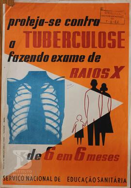 Proteja-se contra a tuberculose fazendo exame de raios x