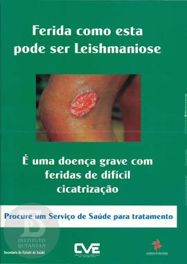 Ferida como esta pode ser Leishmaniose