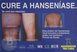 Cure a hanseníase