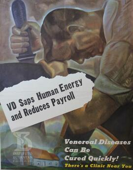 VD Saps Human Energy and Reduces Payroll