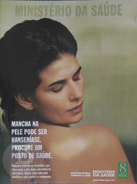 Mancha na pele pode ser hanseníase. Procure um posto de saúde.