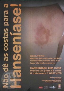 Não dê as costas para a Hanseníase