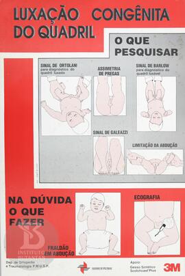 Luxação congênita do quadril