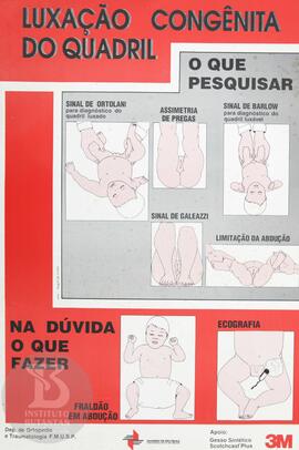 Luxação congênita do quadril