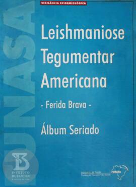 Leishmaniose Tegumentar Americana - ferida brava