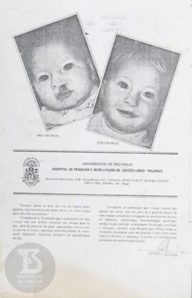 Hospital de Pesquisa e Reabilitação de Lesões Lábio - Palatais